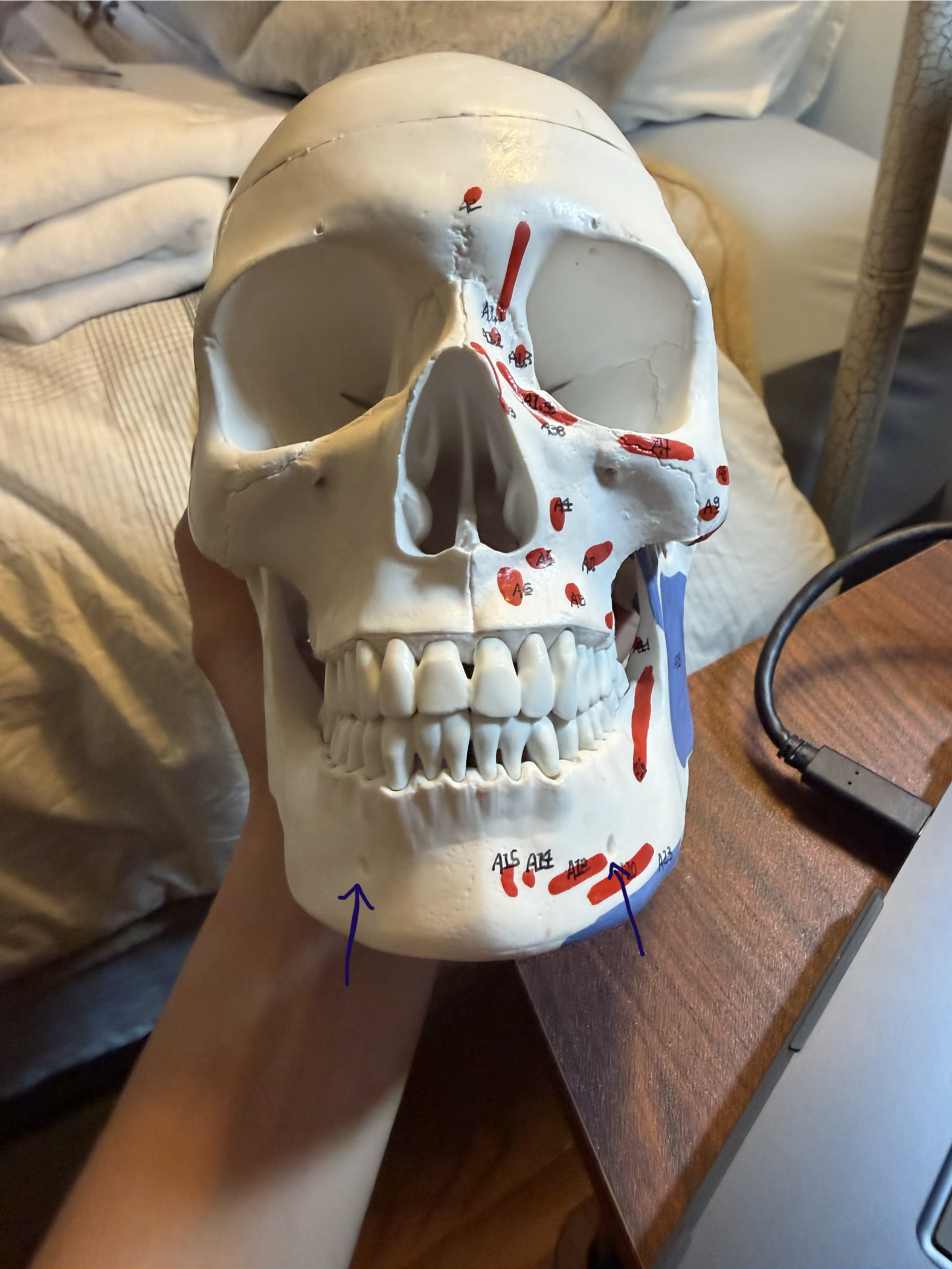 <p>two of them located on the mandible </p>