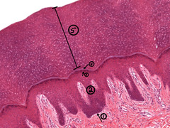 <p>Classify type of epithelium and indicate the layer at each number?</p>