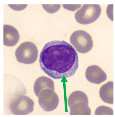 <p>What type of leukocytes are these?</p>