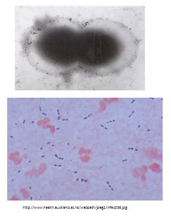 <p>Streptococcus pneumoniae: the pneumoccous</p>