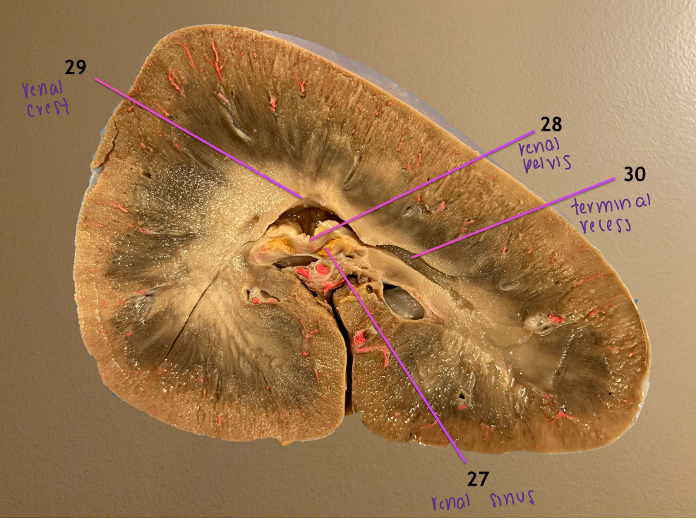 <ol start="27"><li><p>renal sinus: filled w/ fat &amp; surrounds pelvis </p></li><li><p>renal pelvis</p></li><li><p>renal crest: drains urine from center of kidney, flows into 28</p></li><li><p>terminal recess: extension of pelvis that collects urine from the poles </p></li></ol><p>.</p><p>renal hilus</p>