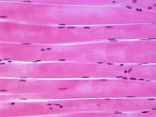 <p>name it → see it</p><p>long cylindrical, looks like meat tbh, organized, multinucleate</p><ul><li><p>attached to the bone</p></li></ul><p></p>