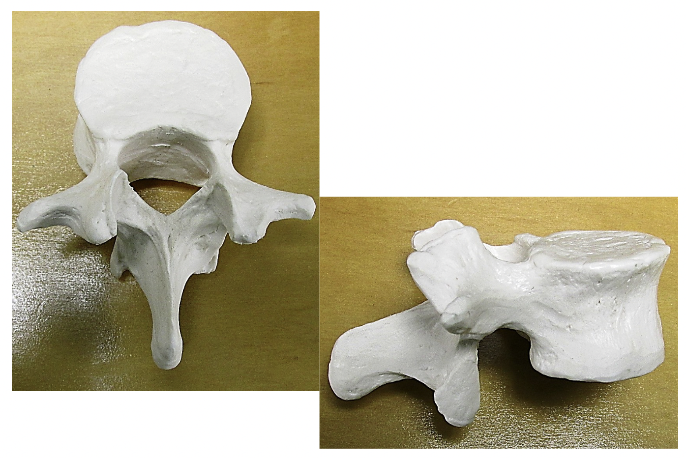 <p>What is the big piece of bone on the end</p>