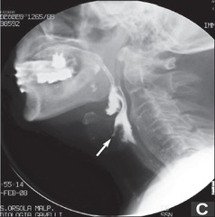 <p>Diagnostic procedure to assess the upper gastrointestinal tract</p>