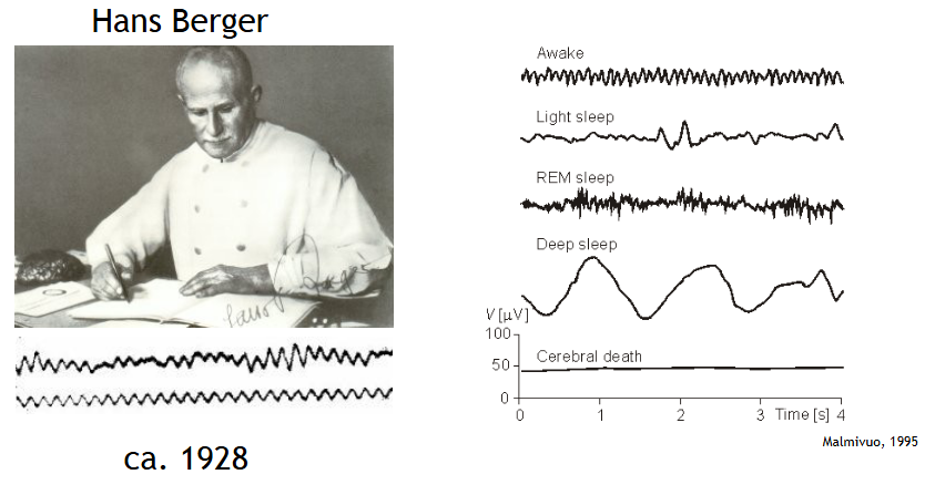 <p>look at the brain worms</p><p>BTW, Berger initially wanted to “find” telepathy…</p>