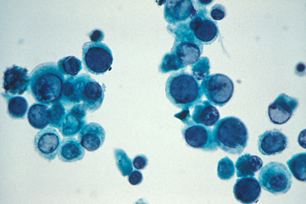 <p>Urines</p><p>1) Diagnostic</p>