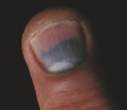 <p></p>