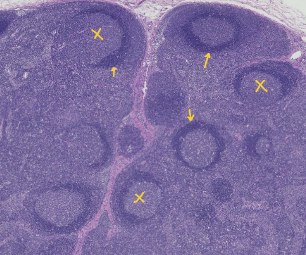 <p>what are the arrows pointing at?</p>