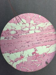 <p>Striated</p><p>Multinucleated</p><p>Non-branching</p><p>Lack cell boundaries</p><p>*Parallel, multinucleated</p>
