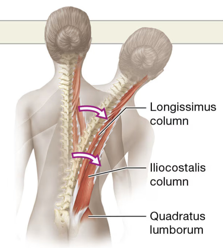 <p>quadratus lumborum muscle</p>