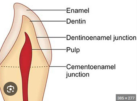 <p>Where enamel meets dentin </p>