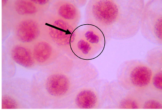 <p><span>Chromatids re-forming into nuclei at<br>opposing ends of the cell and membrane<br>begins to form between them<br>• 2 oval bundles of chromosomes<br>• Like two tight hair buns</span></p>