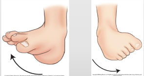 <p>left: eversion (valgus stress) = outward stress movement of foot at ankle joint, toward lateral</p><p>right: inversion (varus stress) = inward stress movement, toward medial </p><p>(abnormal names)</p>