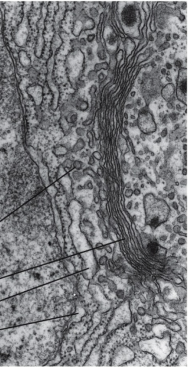 <p>golgi body</p>