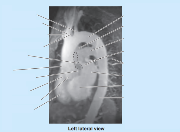 <p>Please label the lateral view of the heart </p>