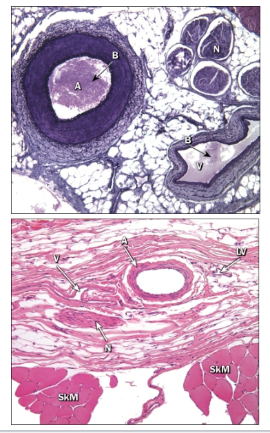 <ul><li><p>Arteries, veins, and nerves typically travel together to form a neurovascular bundle</p></li><li><p>Three main types</p></li><li><p>1. Arteries</p><ul><li><p>Elastic arteries</p></li><li><p>Muscular arteries</p></li><li><p>Arterioles</p></li></ul></li><li><p>2. Veins</p><ul><li><p>Large veins</p></li><li><p>Medium veins</p></li><li><p>Venules</p></li></ul></li><li><p>3. Capillaries</p><ul><li><p>Continuous</p></li><li><p>Fenestrated</p></li><li><p>Sinusoidal</p></li></ul></li></ul><p></p>