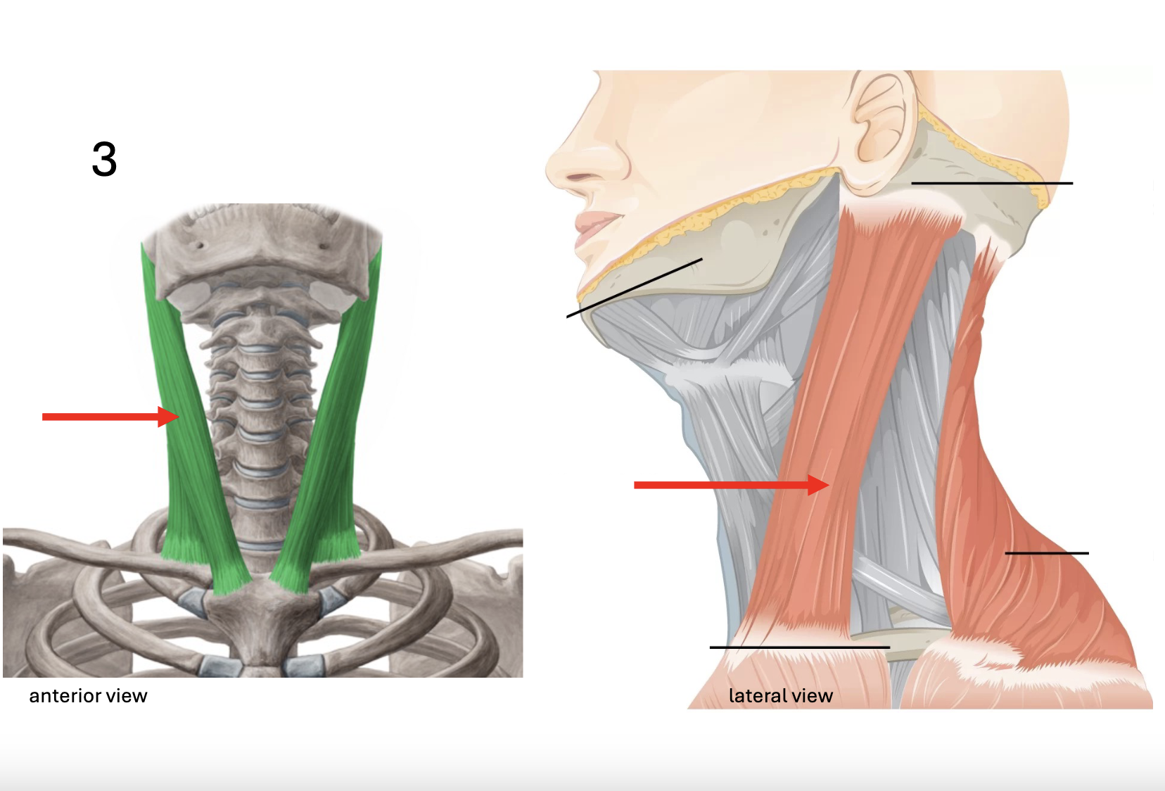 <p>Identify the <strong>muscle</strong></p>