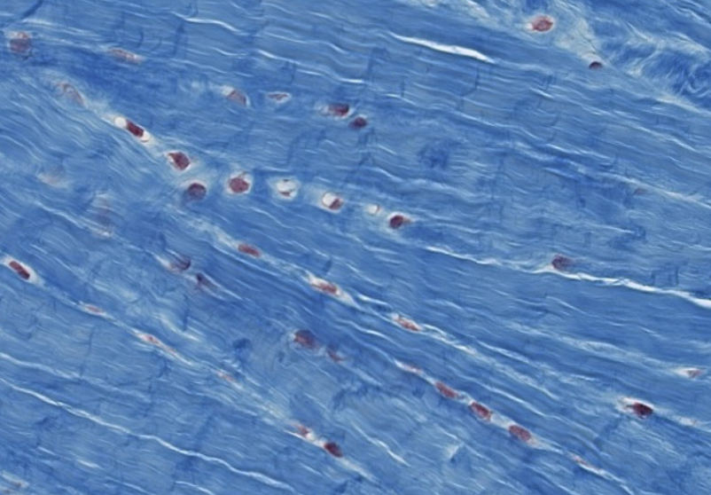 <p>which type of CT is this?</p>