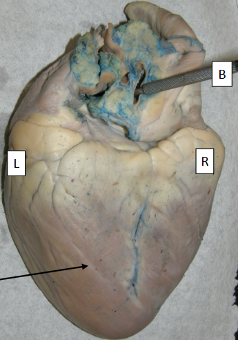 <p>Label B </p>