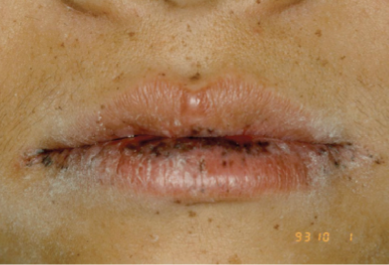 <p>what is this condition</p>