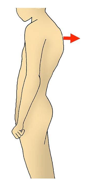 <p>What does the following image display an example of, & how might this occur?</p>