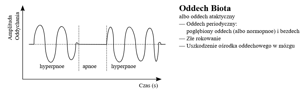 <p><span>szybki, płytki, nieregularny oddech. Okresy bezdechów (10–30 sekund) są przerywane zupełnie bezładnym rytmem oddechowym, poszczególne oddechy różnią się częstotliwością i głębokością</span></p><p><span>- uszkodzenie rdzenia przedłużonego</span></p><p><span>- wzrost ciśnienia śródczaszkowego</span></p><p><span>- śpiączka polekowa</span></p>