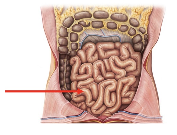 term image