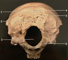 <p>What structure is #4? (Fig. 3.10 Occipital Bone, Inferior View)</p>