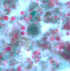 <p>Up to four nuclei</p><p>5-10 mimcrons</p>