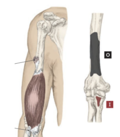 <p>What muscle is this?</p>