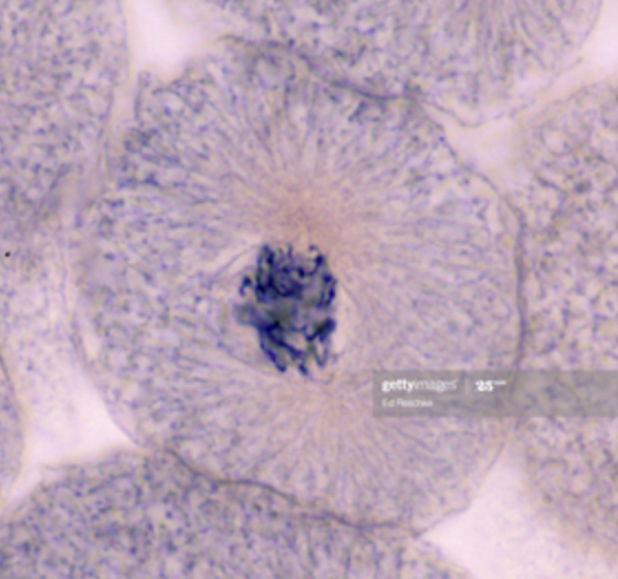 <p>what is this stage of mitosis</p>