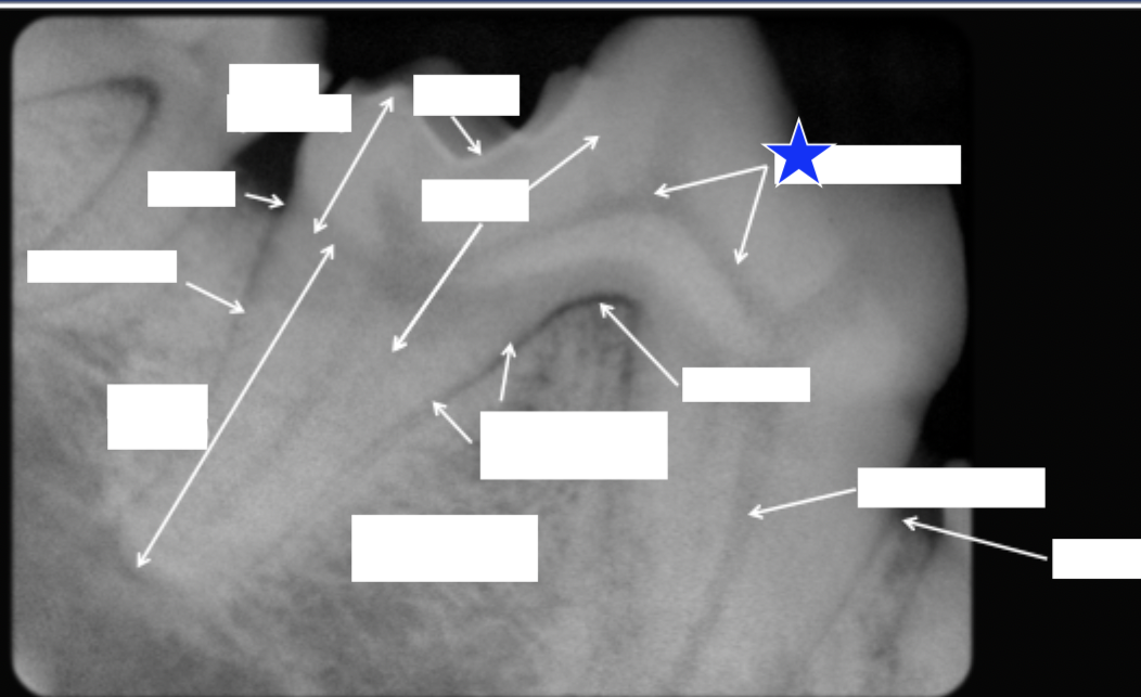 <p>What part of the tooth is indicated by the star?</p>