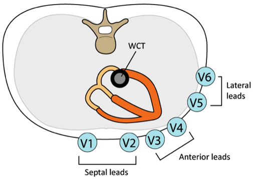 <p>Precordial (V1–V6) leads</p>