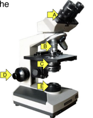 <p>What is arrow B pointing at?</p>