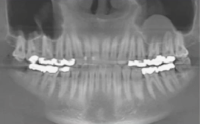 <p>what is the diagnosis? </p>