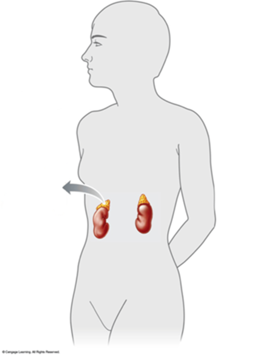 <p>Answer the question using the accompanying figure. The ____ glands are shown in this figure.</p><p>a.</p><p>thyroid</p><p>b.</p><p>pituitary</p><p>c.</p><p>adrenal</p><p>d.</p><p>pancreatic</p><p>e.</p><p>pineal</p>