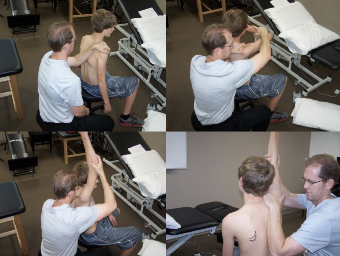 <p>1. Perform Hawkins-Kennedy and Neer tests</p><p>2. Grasp the scapula with the fingers contacting the AC joint anteriorly and the palm and thenar eminence contacting the spine of the scapula posteriorly, with the forearm obliquely angled toward the inferior angle of the scapula for additional support on the medial border.</p><p>3. Apply a moderate force to the scapula to encourage scapular posterior tilting and external rotation, and to approximate the scapula to a mid position on the thorax.</p><p>4. Any pain-provoking test can be repeated with the scapula manually repositioned using the SRT.</p>