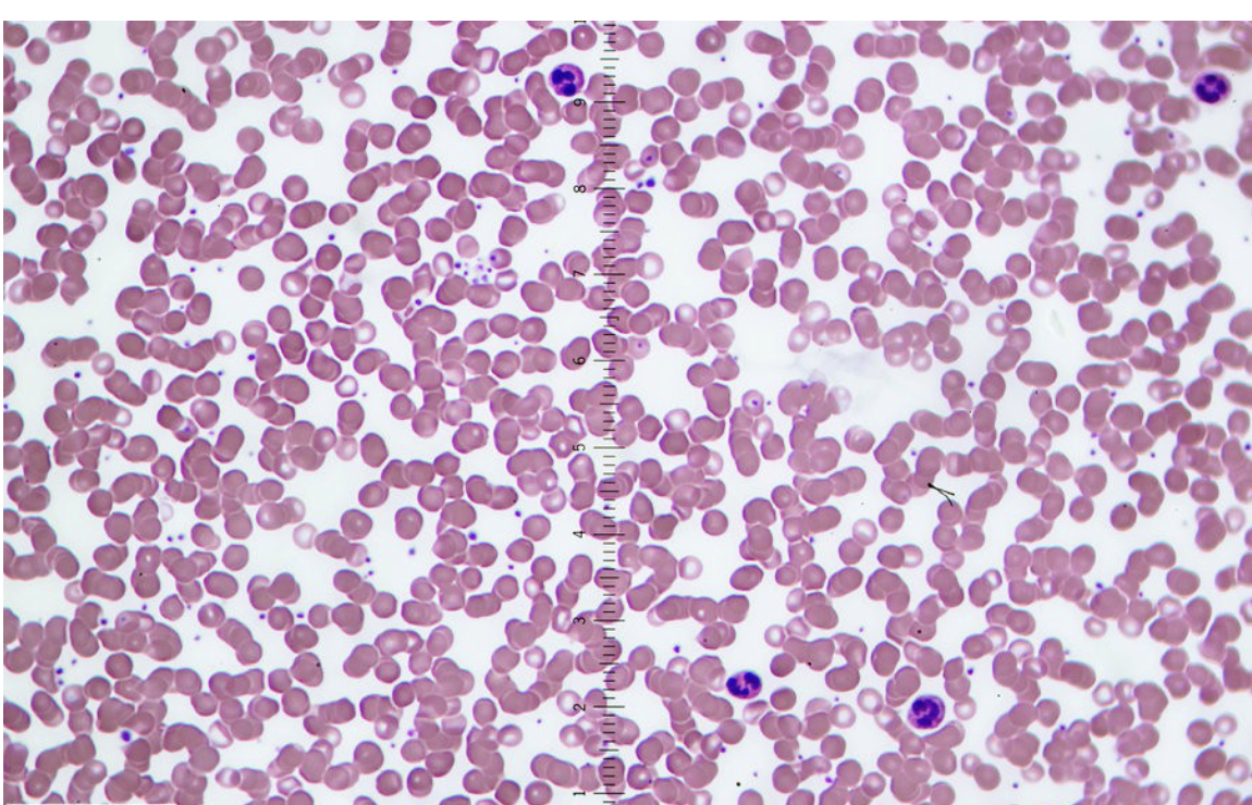 <p>What is this Connective Tissue? and where is it found ?</p>