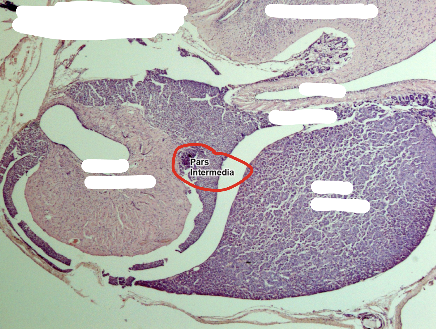<p>Pars intermedia </p>