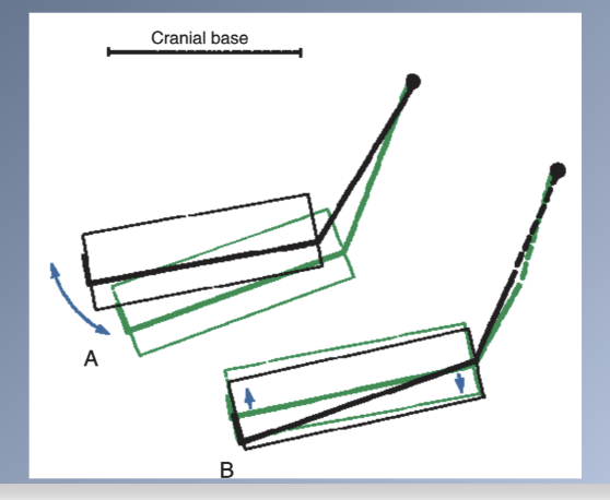 <p><span>MANDIBLE</span><br><span>4. Bjork and Skieller distinguished two contributions to internal rotation (total rotation)</span><br><span>1. Matrix rotation, or rotation around the condyle</span><br><span>2. Intramatrix rotation, or rotation centered within the body of the mandible</span></p>