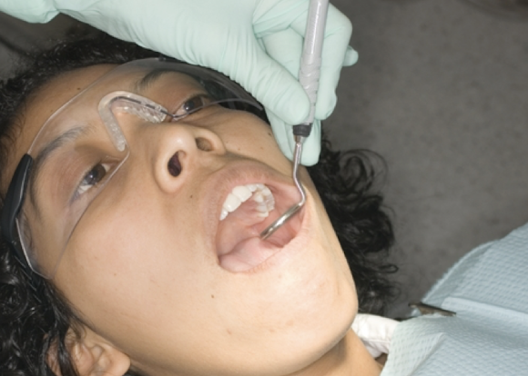 <p>Place it between dental arches, like in a “frisbee-position,” and then turn it to where it is parallel to the buccal mucosa of the cheek</p>