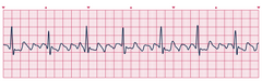 <p>identify the rhythm</p>