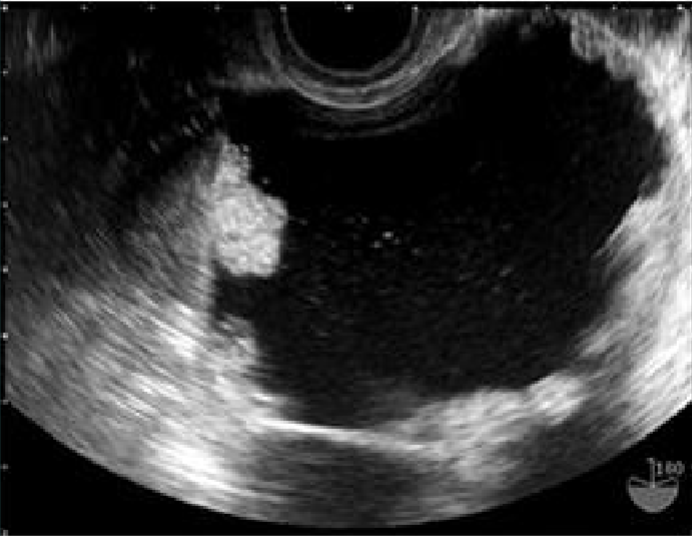 <p>What is this an image of?</p>