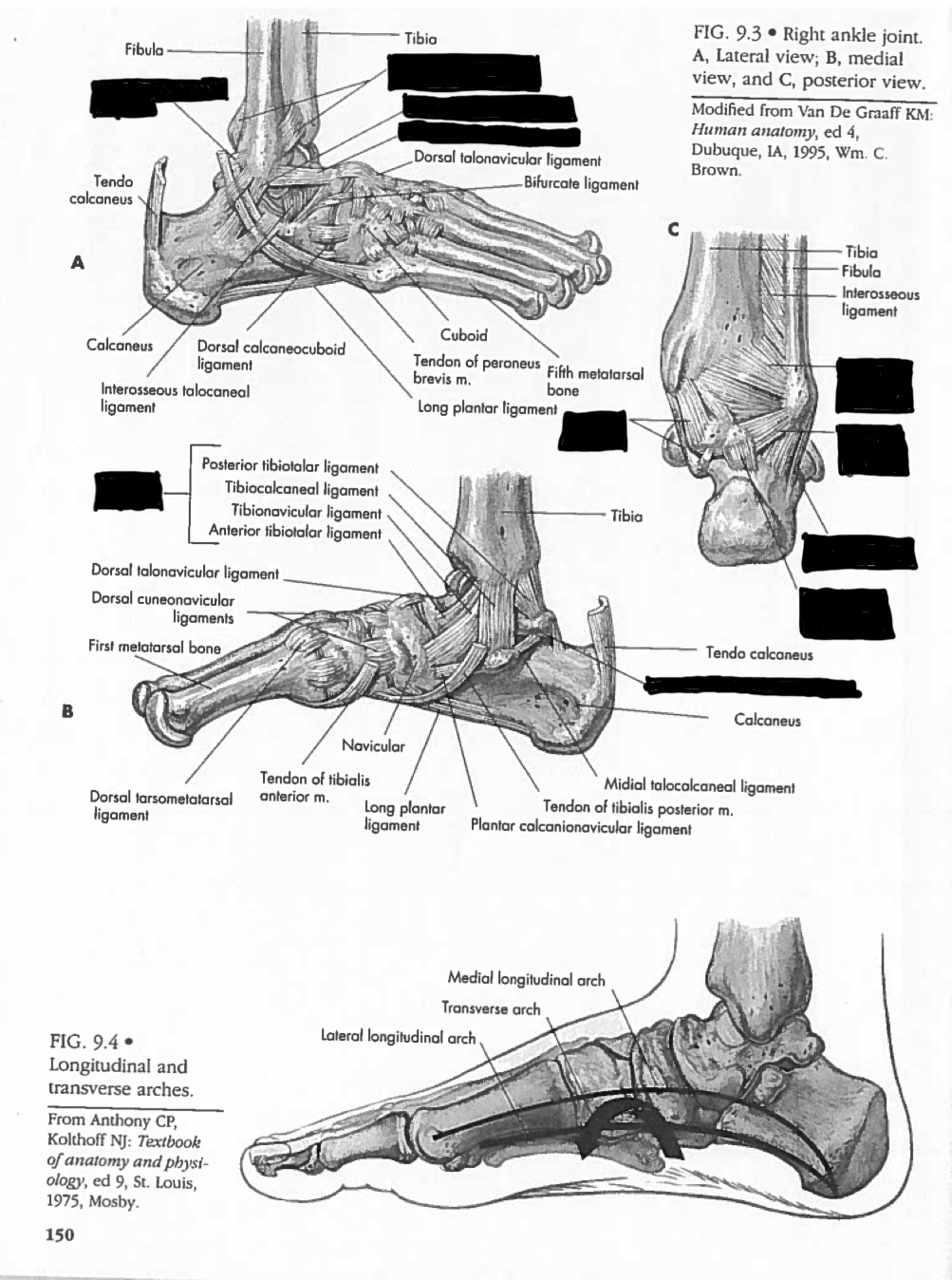 <p>Label these ligaments properly</p>