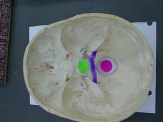 <p><span>Identify the structure labeled by the pink dot AND name the bone it is part of.</span></p>