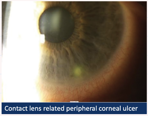 <p>Describe + give diagnosis?</p>