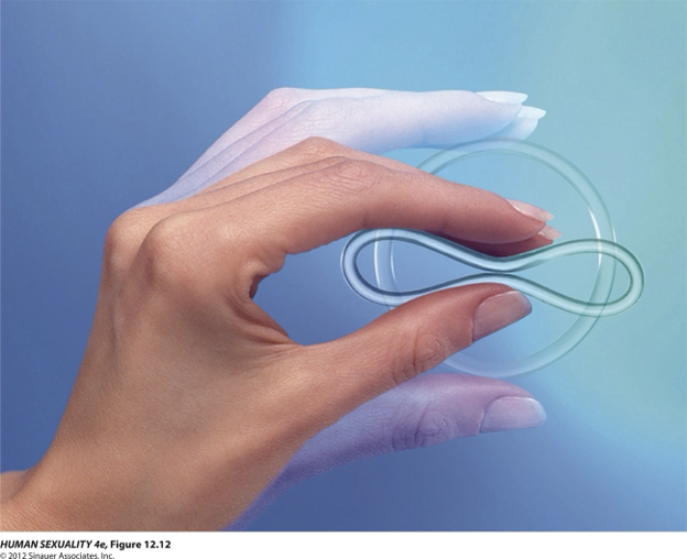 <ul><li><p>21 days inside with a 7-day free break</p></li><li><p>Contain varying amounts of ethinyl estradiol and etonogesteral (synthetic progestin)</p></li><li><p>Mechanisms of Action</p><ul><li><p>Primarily inhibits ovulation</p></li><li><p>Thickens cervical mucus</p></li><li><p>Interfere with fertilization by altering tubal motility of ovum</p></li><li><p>Inflammation and atrophy of the endometrial lining</p></li></ul></li></ul><p></p>