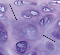 <p>Which part of the hyaline cartilage ECM is the arrow pointing to (in between light and dark staining)?</p>