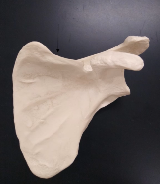 <p>What is this border?</p>