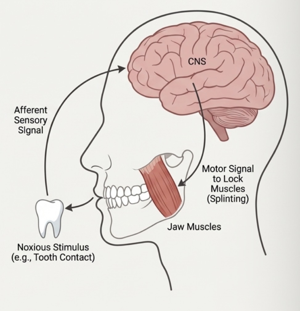 <p>Initial physiological response (muscle splinting) to protect an injured part </p><p>Alteration of sensory stimulus, constant deep pain or acute increase in stress</p><p>Appears immediately after stimulus, persists for few days </p><p>Causes reduced range of motion, but can achieve MO </p><p>Minimal pain at rest but increases with function, muscle weakness </p>